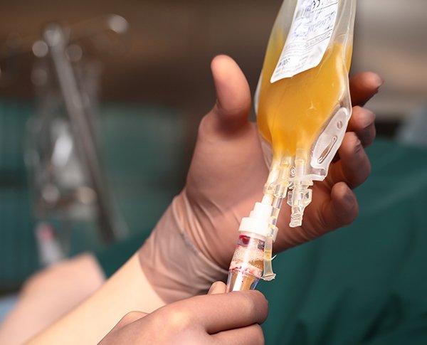 Photo of bag of plasma for transfusion. Photo by Getty Images.