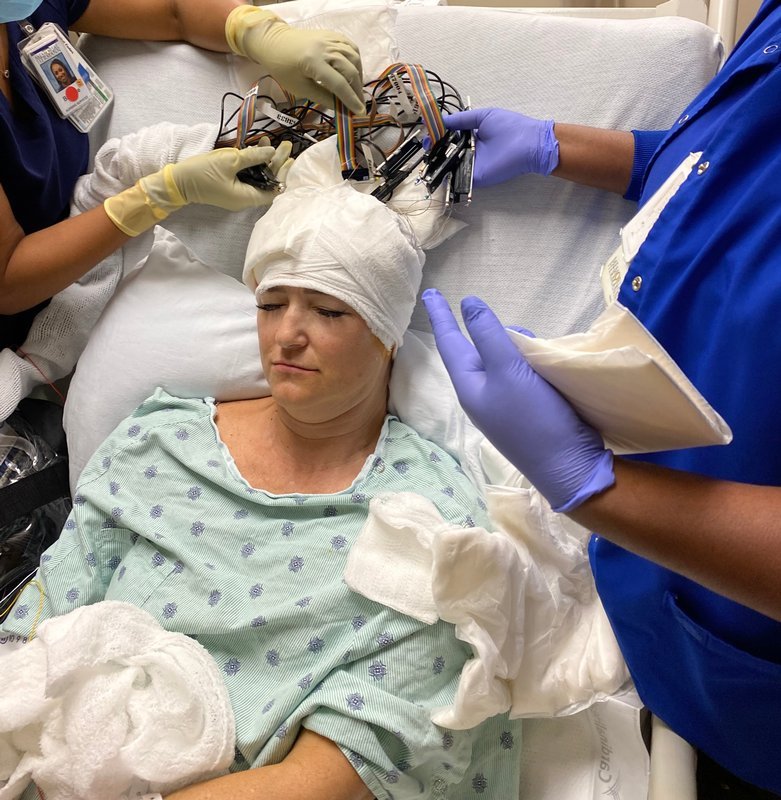 In March 2021, Tiffeny Morrow underwent an intense SEEG scan to locate the source of her seizures: a genetic abnormality known as periventricular nodular heterotopia. (Photo courtesy of Tiffeny Morrow)