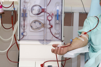 Photo of patient receiving dialysis. (Photo credit: Getty Images)