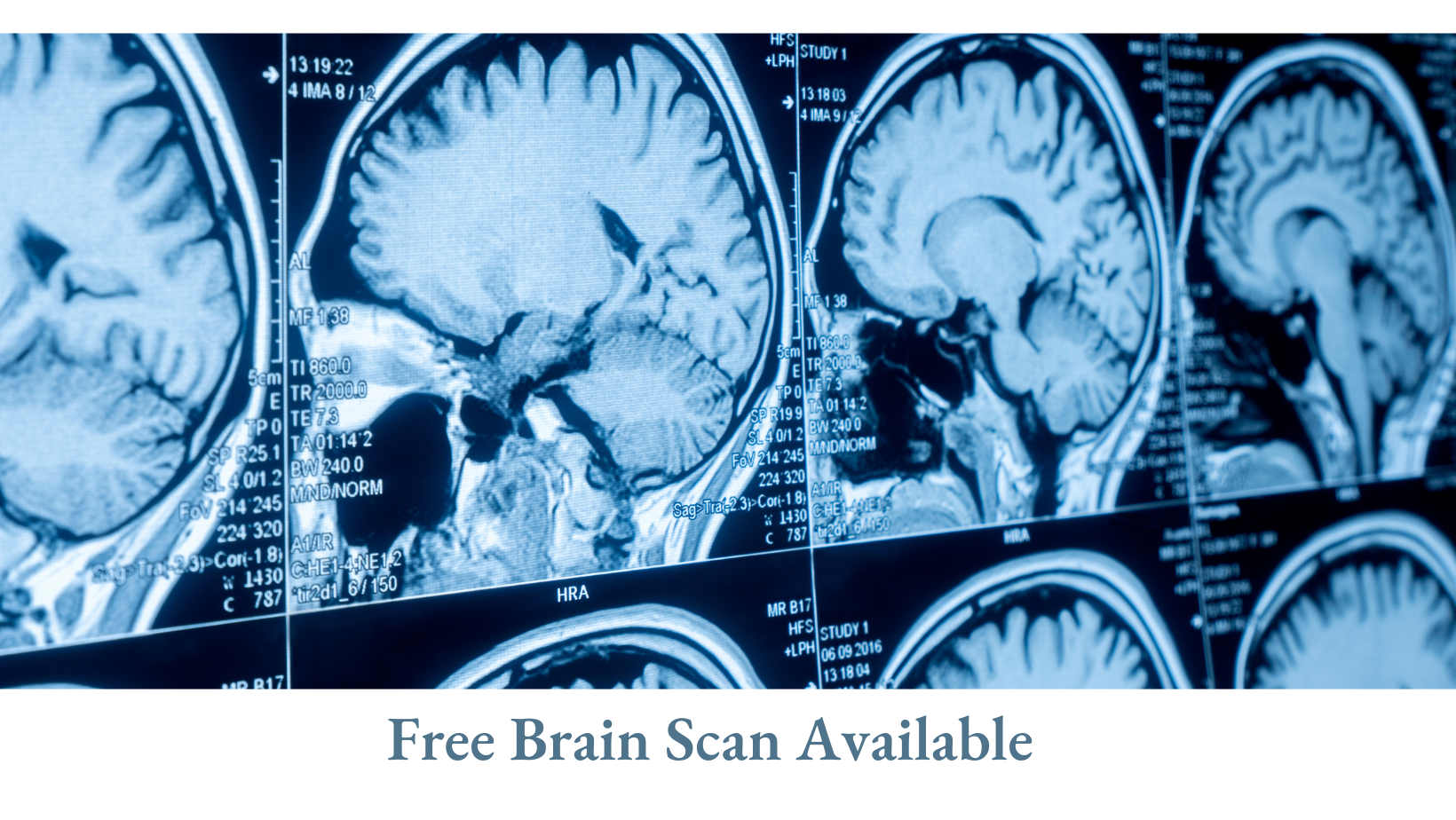 Participate in a brain health study and receive a free brain scan