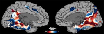 Image showing a map of the brain surface showing regions that preferentially activate during face (blue) and scene (red) identification.
