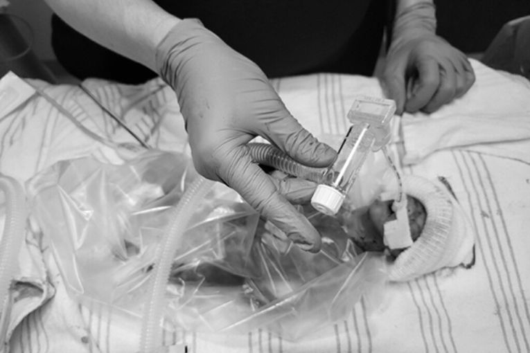 Jeremiah Salazar was the first baby at Children’s Memorial Hermann Hospital that used a 2.0-mm endotracheal tube introduced by Matthew Rysavy, MD, PhD, through the international Tiny Baby Collaborative.  (Photo Courtesy of Paola Salazar)
