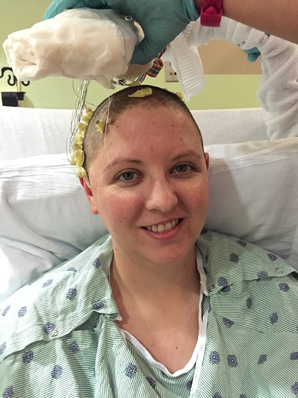 Photo of Alisha Mehaffey having electrodes implanted via fine probes. Photo credit is Maricruz Kwon/UTHealth