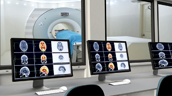 UTHealth Houston researchers preformed PET scans on patients to study the affects of deep brain stimulation for treatment-resistant depression. (Photo by Getty Images)