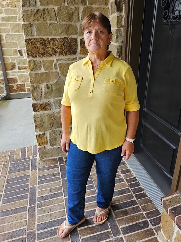 More than two years after her spinal fusion surgery, Ruth Bischoff, 69, stands tall at her home in October 2023. (Photo provided by Ruth Bischoff)