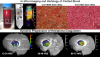 Dynamic Imaging of Blood Coagulation Within the Hematoma of Patients With Acute Hemorrhagic Stroke