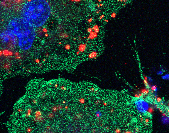 Image of a phagocytic cell marked in the color green with engulfed dead apoptotic neurons marked in the color red during cleanup process. Photo by Shun-Ming Ting from UTHealth