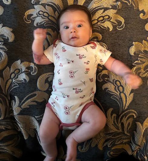 Since her surgery in November 2023, the mass on Isabella's arm is significantly smaller, and her mother loves being home with her. (Photo courtesy of Claudia Salas Melchor)