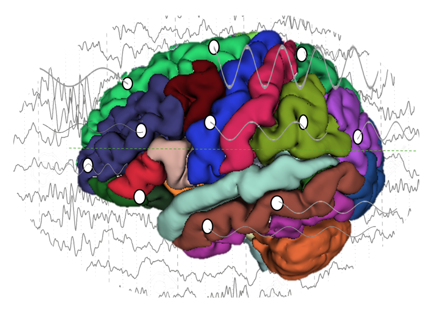 EpiEx - Epilepsy Exchange Meeting