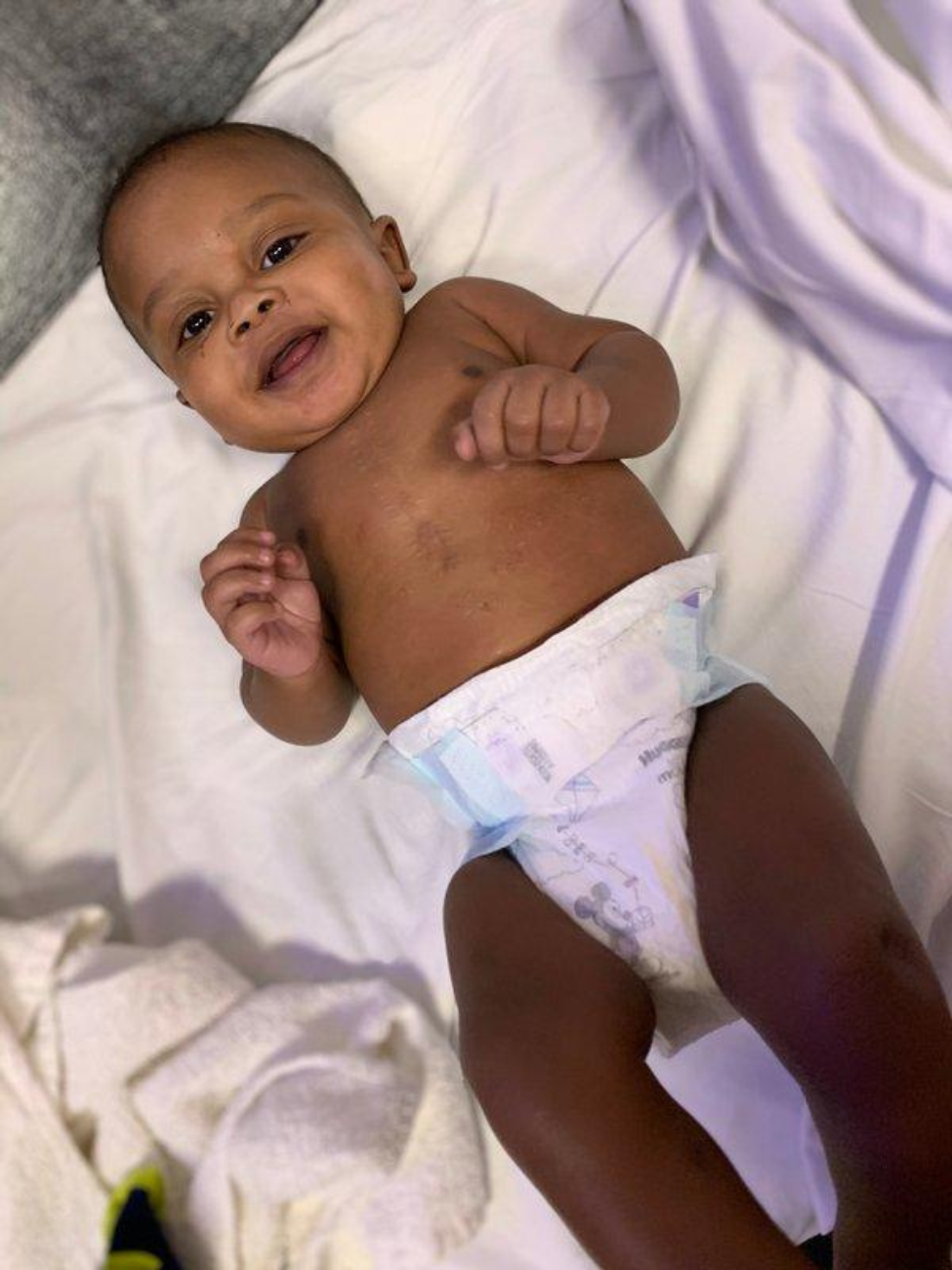 Doctors in his home state didn’t think Imani was old enough to receive the life-saving surgery he needed. (Photo by Amira Carson)