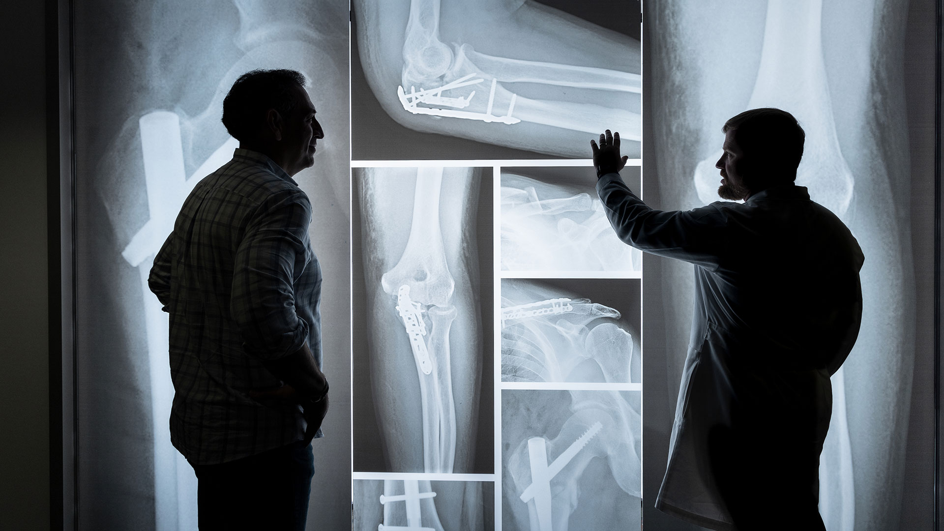 UTHealth Houston physician reviews orthopedic X-rays with a colleague, pointing to medical images that show repaired fractures and joint implants, highlighting collaboration, diagnostic expertise, and musculoskeletal care.