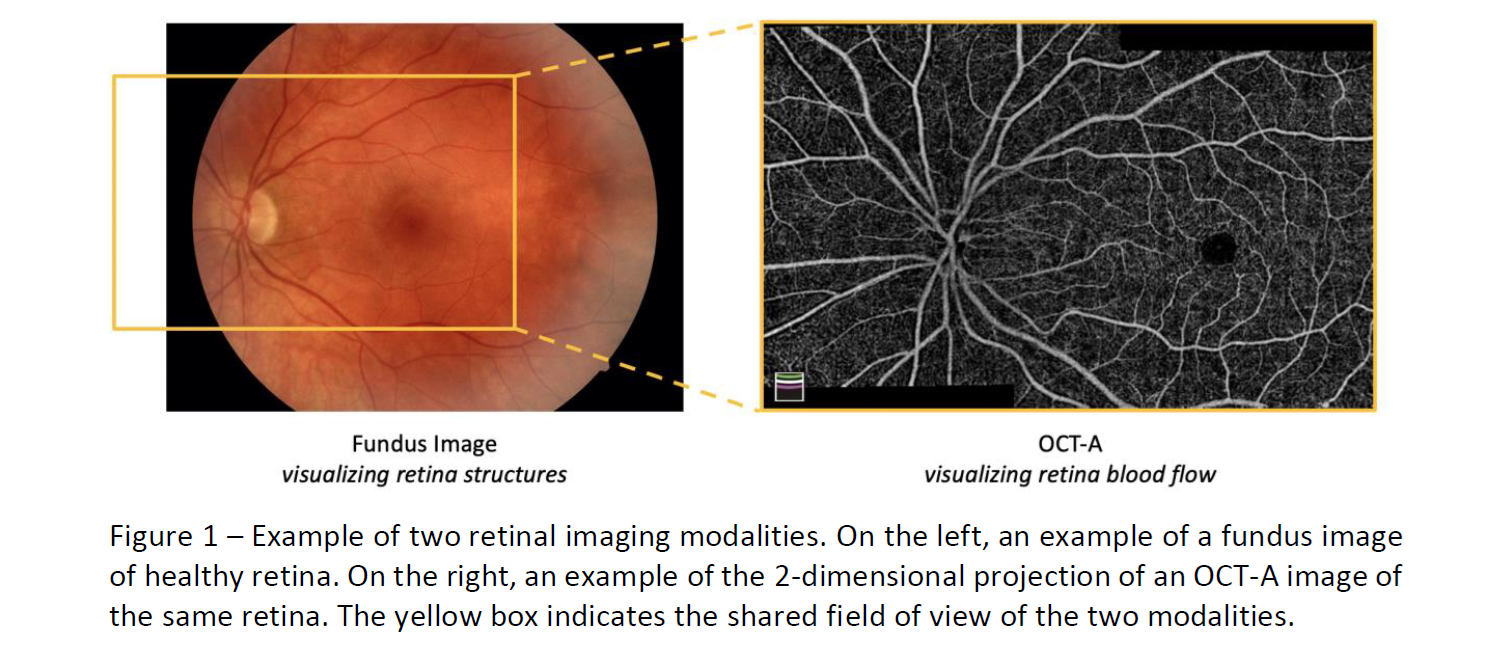 Retina-study-image-2