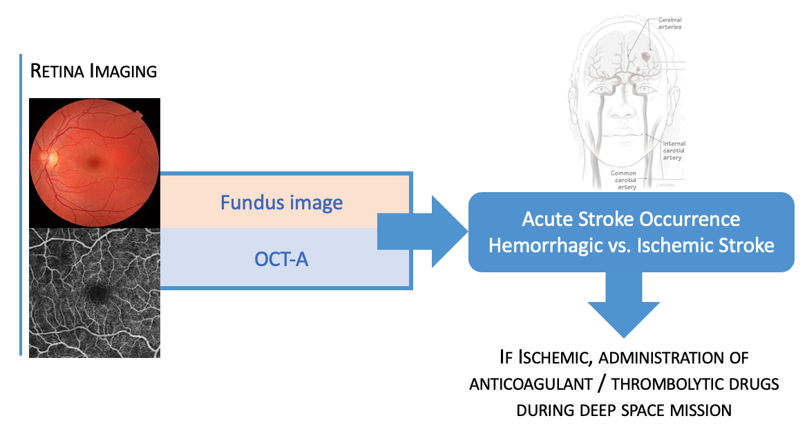 When there is a Fundus image and OCT-A there's either Acute Stroke Occurence Hemorrhagic or Ischemic Stroke. If ischemic, administer anticoagulant/thrombolytic drugs during deep space mission.
