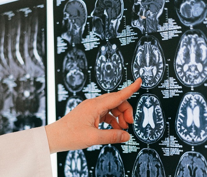 Hand reviewing brain scan